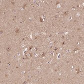 Anti-PARP3 antibody produced in rabbit Prestige Antibodies® Powered by Atlas Antibodies, affinity isolated antibody, buffered aqueous glycerol solution