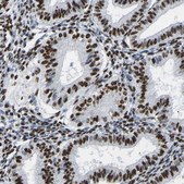 Anti-RBL2 antibody produced in rabbit Prestige Antibodies® Powered by Atlas Antibodies, affinity isolated antibody, buffered aqueous glycerol solution