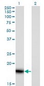 Monoclonal Anti-PLA2G16 antibody produced in mouse clone 4C4-2A11, purified immunoglobulin, buffered aqueous solution