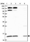Anti-CMC1 antibody produced in rabbit Prestige Antibodies® Powered by Atlas Antibodies, affinity isolated antibody, buffered aqueous glycerol solution