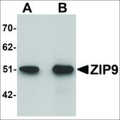 Anti-ZIP9 antibody produced in rabbit affinity isolated antibody, buffered aqueous solution