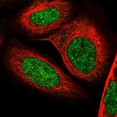 Anti-TAF8 antibody produced in rabbit Prestige Antibodies® Powered by Atlas Antibodies, affinity isolated antibody, buffered aqueous glycerol solution