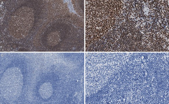 Anti-Smith Antigen Antibody, clone Y12 | Sigma-Aldrich