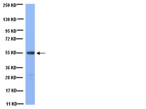 Anticuerpo anti--tubulina, clon YL1/2 clone YL1/2, Chemicon&#174;, from rat