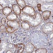Anti-STRA6 antibody produced in rabbit Prestige Antibodies® Powered by Atlas Antibodies, affinity isolated antibody, buffered aqueous glycerol solution