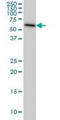 Monoclonal Anti-AHCYL1 antibody produced in mouse clone 5D6, purified immunoglobulin, buffered aqueous solution