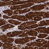 Anti-EMID1 antibody produced in rabbit Prestige Antibodies® Powered by Atlas Antibodies, affinity isolated antibody, buffered aqueous glycerol solution