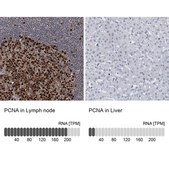 Anti-PCNA antibody produced in rabbit Prestige Antibodies® Powered by Atlas Antibodies, affinity isolated antibody, buffered aqueous glycerol solution, ab2
