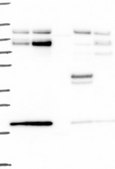Anti-FOXK2 antibody produced in rabbit Prestige Antibodies® Powered by Atlas Antibodies, affinity isolated antibody, buffered aqueous glycerol solution