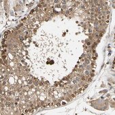 Anti-EIF1AX antibody produced in rabbit Prestige Antibodies® Powered by Atlas Antibodies, affinity isolated antibody, buffered aqueous glycerol solution