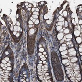 Anti-PTPRR antibody produced in rabbit Prestige Antibodies® Powered by Atlas Antibodies, affinity isolated antibody, buffered aqueous glycerol solution