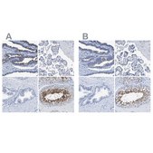 Anti-DNAI1 antibody produced in rabbit Prestige Antibodies® Powered by Atlas Antibodies, affinity isolated antibody, buffered aqueous glycerol solution, Ab1