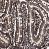 Anti-RNF114 antibody produced in rabbit Prestige Antibodies® Powered by Atlas Antibodies, affinity isolated antibody, buffered aqueous glycerol solution