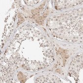 Anti-RPS6KL1 antibody produced in rabbit Prestige Antibodies® Powered by Atlas Antibodies, affinity isolated antibody, buffered aqueous glycerol solution, ab2