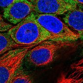 Anti-USH1C antibody produced in rabbit Prestige Antibodies® Powered by Atlas Antibodies, affinity isolated antibody, buffered aqueous glycerol solution, ab1