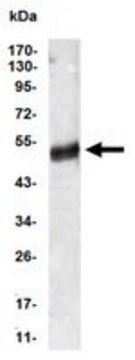 Anti-AGT, clone 1B1 Antibody