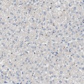 Anti-MAP4K2 antibody produced in rabbit Ab1, Prestige Antibodies® Powered by Atlas Antibodies, affinity isolated antibody, buffered aqueous glycerol solution