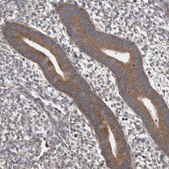 Anti-DDX6 antibody produced in rabbit Prestige Antibodies® Powered by Atlas Antibodies, affinity isolated antibody, buffered aqueous glycerol solution
