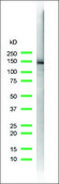 Anti-E-Cadherin antibody, Rabbit monoclonal recombinant, expressed in proprietary host, clone SP64, affinity isolated antibody