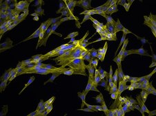 YUMM5.4 Mouse Melanoma Cell Line