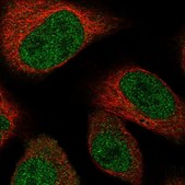 Anti-TADA3 antibody produced in rabbit Prestige Antibodies® Powered by Atlas Antibodies, affinity isolated antibody, buffered aqueous glycerol solution