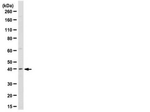 Anti-RNF110/PCGF2 Antibody from rabbit, purified by affinity chromatography