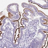 Anti-SI antibody produced in rabbit Prestige Antibodies® Powered by Atlas Antibodies, affinity isolated antibody, buffered aqueous glycerol solution