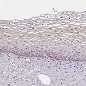 Anti-HOPX antibody produced in rabbit Prestige Antibodies® Powered by Atlas Antibodies, affinity isolated antibody, buffered aqueous glycerol solution