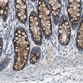 Anti-CANT1 antibody produced in rabbit Prestige Antibodies® Powered by Atlas Antibodies, affinity isolated antibody, buffered aqueous glycerol solution, Ab2