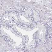 Anti-PAX3 antibody produced in rabbit Prestige Antibodies® Powered by Atlas Antibodies, affinity isolated antibody, buffered aqueous glycerol solution