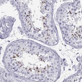 Anti-ACTL7A antibody produced in rabbit Prestige Antibodies® Powered by Atlas Antibodies, affinity isolated antibody, buffered aqueous glycerol solution, Ab1