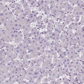 Anti-ADAM12 antibody produced in rabbit Prestige Antibodies® Powered by Atlas Antibodies, affinity isolated antibody, buffered aqueous glycerol solution