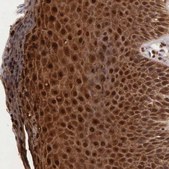 Anti-CSTA antibody produced in rabbit Prestige Antibodies® Powered by Atlas Antibodies, affinity isolated antibody, buffered aqueous glycerol solution
