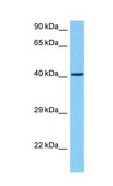 Anti-KLF8 (AB2) antibody produced in rabbit affinity isolated antibody
