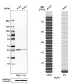 Anti-PSPH antibody produced in rabbit Prestige Antibodies® Powered by Atlas Antibodies, affinity isolated antibody, buffered aqueous glycerol solution