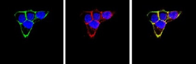Anti-Integrin &#946;1 Antibody, clone 6S6 clone 6S6, Chemicon&#174;, from mouse