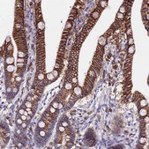 Anti-CSRP2 antibody produced in rabbit Prestige Antibodies® Powered by Atlas Antibodies, affinity isolated antibody, buffered aqueous glycerol solution