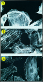Monoclonal Anti-α-Actinin antibody produced in mouse clone BM-75.2, ascites fluid