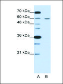 Anti-FZD5 antibody produced in rabbit affinity isolated antibody