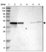 Anti-NDRG3 antibody produced in rabbit Prestige Antibodies® Powered by Atlas Antibodies, affinity isolated antibody, buffered aqueous glycerol solution