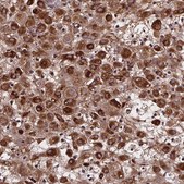 Anti-AEBP1 antibody produced in rabbit Prestige Antibodies® Powered by Atlas Antibodies, affinity isolated antibody, buffered aqueous glycerol solution