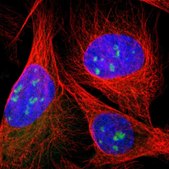 Anti-DDX10 antibody produced in rabbit Prestige Antibodies® Powered by Atlas Antibodies, affinity isolated antibody, buffered aqueous glycerol solution