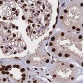 Anti-HDGF antibody produced in rabbit Prestige Antibodies® Powered by Atlas Antibodies, affinity isolated antibody, buffered aqueous glycerol solution