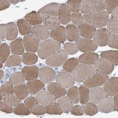 Anti-SBK2 antibody produced in rabbit Prestige Antibodies® Powered by Atlas Antibodies, affinity isolated antibody, buffered aqueous glycerol solution