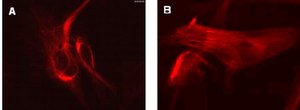 LentiBrite RFP-Vimentin Lentiviral Biosensor
