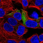 Anti-RPS3A antibody produced in rabbit Prestige Antibodies® Powered by Atlas Antibodies, affinity isolated antibody, buffered aqueous glycerol solution
