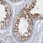 Anti-METTL14 antibody produced in rabbit Prestige Antibodies® Powered by Atlas Antibodies, affinity isolated antibody, buffered aqueous glycerol solution