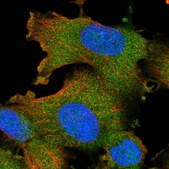 Anti-STK16 antibody produced in rabbit Prestige Antibodies® Powered by Atlas Antibodies, affinity isolated antibody, buffered aqueous glycerol solution