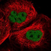 Anti-KNL1 antibody produced in rabbit Prestige Antibodies® Powered by Atlas Antibodies, affinity isolated antibody, buffered aqueous glycerol solution