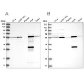 Anti-ALDH6A1 antibody produced in rabbit Prestige Antibodies® Powered by Atlas Antibodies, affinity isolated antibody, buffered aqueous glycerol solution, ab3